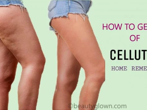 how to get rid of cellulite,get rid of cellulite,how to get rid of cellulite naturally,how to get rid of cellulite on thighs,how to get rid of cellulite fast,how to get rid of cellulite on legs,get rid of cellulite fast,get rid of cellulite naturally,how to reduce cellulite,how to remove cellulite,cellulite,how to get rid of cellulite on stomach
