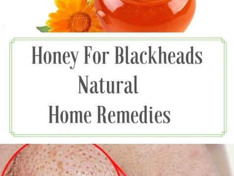 how to remove blackheads,blackheads,how to get rid of blackheads,remove blackheads at home,blackheads removal,how to remove whiteheads,how to get clear skin,how to remove blackheads at home,home remedies to remove blackheads and whiteheads,how to get rid of whiteheads,get rid of blackheads,how to remove a blackhead
