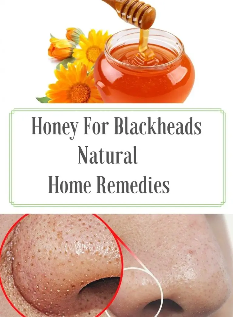 How To Remove Blackheads Home Remedies With Honey 9213