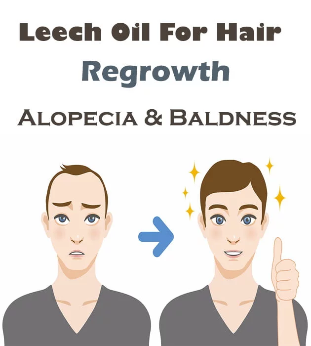 Nature Sure Leech Oil For Hair Regrowth Review Ingredients Price  Buy  Online India